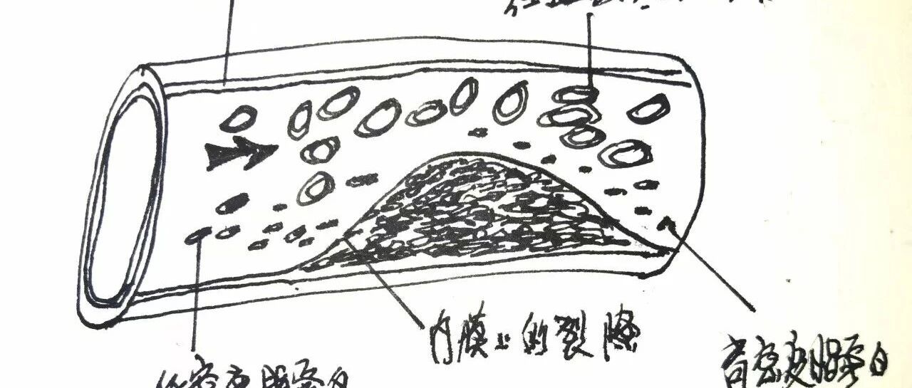 &ldquo;好胆固醇&rdquo;多些好，但非越多越好